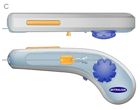 A very early concept rendering of a medical device.