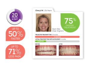 Graphic showing how Acceledent Optima speeds up treatment
